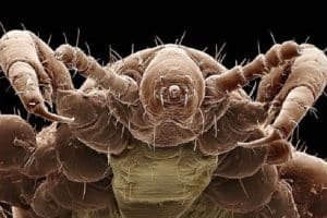 Insectos En Los Sueños | Conoce El Significado De Soñar Con Piojos Y Garrapatas