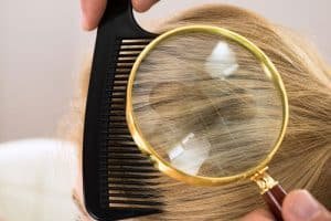 Que Significan Los Sueños Con Piojos Muertos | Conoce Ya Su Interpretación
